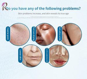 Dispositivo de Crioelectroporación para Rejuvenecimiento Facial, Personalización Gratuita OEM, Criofacial D Cool para Iluminar la Piel y Reducir los Poros - Product Image 2