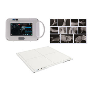 Akciğer tanı merkezi kullanımı dijital taşınabilir <span class=keywords><strong>x</strong></span>-<span class=keywords><strong>ray</strong></span> radyografi sistemi insan vücudu için taşınabilir 70KV göğüs <span class=keywords><strong>X</strong></span> ışını sistemi - Product Image 2
