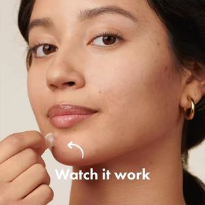 48 Parches Hidrocoloides para el Cuidado Facial, Perfeccionadores, Anti-Acné, Reparadores, Parches Invisibles para el Acné, Uso Diurno y Nocturno - Product Image 5