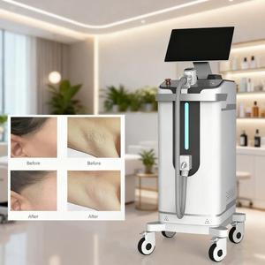 Machine laser diode Nd Yag 2 en 1 certifiée CE, 755/808/1064 nm, refroidissement par glace, épilation, élimination de tous les types de tatouages - Product Image 1