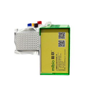 Servicios químicos personalizados Rat PCT (prueba <span class=keywords><strong>de</strong></span> cáncer <span class=keywords><strong>de</strong></span> próstata) Kit Elisa - Product Image 2