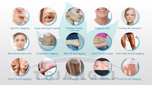 Tragbare Laser-Fett absaugung maschine Faserlaser diode 1470nm 980nm Endo laser-Fett absaugung laser - Product Image 6