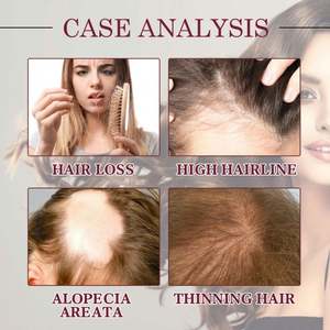 น้ำมันบำ<span class=keywords><strong>รุ</strong></span><span class=keywords><strong>ง</strong></span>ผ<span class=keywords><strong>ม</strong></span>โอฮอย สำหรับผู้ชายและผู้หญิง ป้องกันผ<span class=keywords><strong>ม</strong></span>ร่วง ไบโอติน น้ำมัน<span class=keywords><strong>ม</strong></span>ะพร้าว แม่เอิร์ธ ไทยแลนด์ น้ำมันหัวหอมแด<span class=keywords><strong>ง</strong></span> สำหรับ<span class=keywords><strong>ผม</strong></span>ยาว บำ<span class=keywords><strong>รุ</strong></span><span class=keywords><strong>ง</strong></span>เส้นผ<span class=keywords><strong>ม</strong></span> ลดการหลุดร่ว<span class=keywords><strong>ง</strong></span> สำหรับผู้มีปัญหา<span class=keywords><strong>ผม</strong></span>ร่วง - Product Image 3