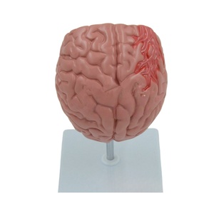 Modelos anatómicos cerebrales patológicos Hemorragia cerebral, tumores y modelo de enfermedad cerebral por accidente cerebrovascular - Product Image 4