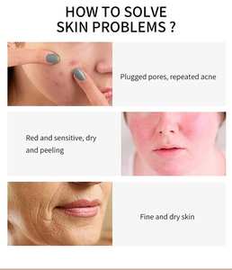 100% Natürliches Bio-Kollagen-Maskenpulver, Vitamin C & Mineralien, Gel-Gesichtsmaske für Aufhellung, Aknebehandlung mit Rosenblättern - Product Image 4