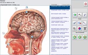 Yüksek kaliteli Body NLS siyah rus cilt analizörü vücut sağlığı tamamlayıcı alternatif için klinik analitik enstrüman - Product Image 3