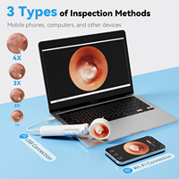 Otoskop WiFi Pintar HD Pembersih Telinga Visual Endoskop Kamera Telinga Nirkabel Alat Pengangkat Kotoran Telinga Portabel