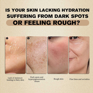 <span class=keywords><strong>Crema</strong></span> Viso Calantha Biologica Vegana al Collagene, <span class=keywords><strong>Acido</strong></span> <span class=keywords><strong>Ialuronico</strong></span> e Riso, <span class=keywords><strong>con</strong></span> Vitamina E, Idratante, Antirughe, Sbiancante e Rassodante, 50g - Product Image 3