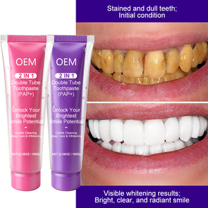 Dentifrice blanchissant personnalisé avec logo, fluorure, haleine fraîche, format voyage 100g - Product Image 1