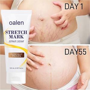 Crema Reparadora de Cicatrices, Tratamiento <span class=keywords><strong>para</strong></span> Manchas de Acné, Crema <span class=keywords><strong>para</strong></span> Eliminar Estrías, Suavizante, Reafirmante e Hidratante <span class=keywords><strong>para</strong></span> <span class=keywords><strong>el</strong></span> Cuidado de la Piel - Product Image 4