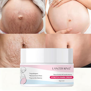 ملصقات مخصصة كريم طبيعي لعلامات التمدد للنساء الحوامل - Product Image 1