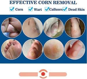 Corn Removal Pads Household Transdermal Skin Color Foot Pain Relieving Foot Corn Remover <strong>Plaster</strong> - Product Image 5