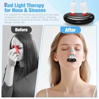Appareil intelligent de thérapie par lumière rouge électrique pour le nez, soulagement de la rhinite, photothérapie, alimentation USB/batterie, autonomie de 70 minutes, soins en voiture