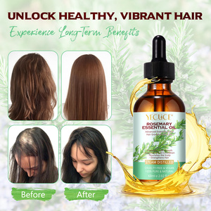Yecuce Huiles Essentielles Traitement Du Cuir Chevelu Sec Aceite Para El Cabello Soins Des <span class=keywords><strong>Cheveux</strong></span> Produits Épaississants <span class=keywords><strong>Huile</strong></span> De Romarin pour Femmes - Product Image 2