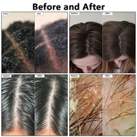 Máquina de Alta Calidad para el Crecimiento del Cabello, Estilo Coreano, Cuidado del Cuero Cabelludo, Masajeador Bio para el Cuero Cabelludo, para Salón de Belleza