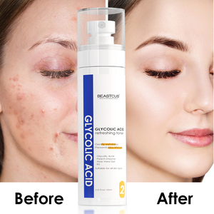 NUEVO LOOKING Spray Oem-<span class=keywords><strong>ordinary</strong></span> Face Skin Care <span class=keywords><strong>7</strong></span>% Ácido glicólico Suero de ácido de frutas Hidratante Eliminar puntos negros Toner - Product Image 3