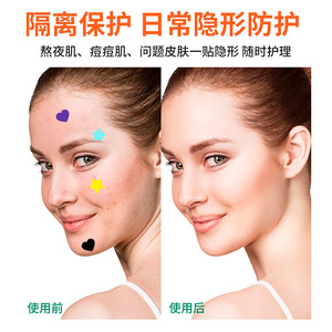 Parches para el acné con forma de corazón y estrella, 10 mm x 10 unidades, tratamiento para el acné, cuidado de la piel del rostro - Product Image 3