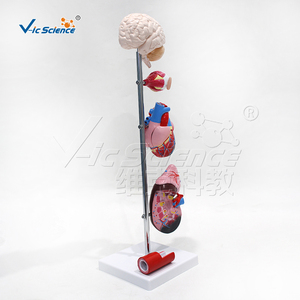 Modelo Anatómico Médico de Patología, Modelo Educativo de Hipertensión, Modelo de Enseñanza de Presión Arterial Alta, Anatomía del Cuerpo Humano - Product Image 3
