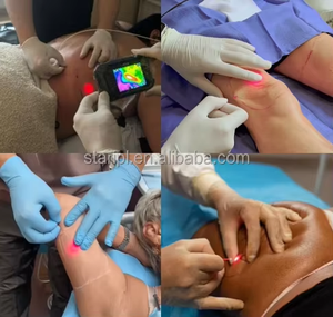 Chuyên nghiệp gây mê Máy 980nm 1470nm hút mỡ cannula mông phụ tiêm hút mỡ Laser nâng mặt - Product Image 4