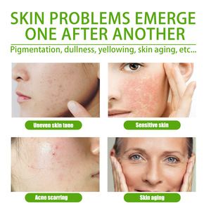 Moisturizing Natural <b>Face</b> Serum Bright Skin Care Whitening Moisturizer Pimples Dark Black Spot Remover - Product Image 3