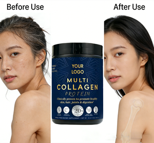 Protéine de lactosérum Gold Standard en poudre – Boissons protéinées pour la gym et le fitness quotidien – Complément de santé OEM - Product Image 2
