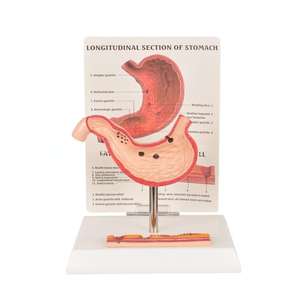 Modèle d'enseignement médical Modèle de démonstration d'évolution de l'estomac pathologique, outil anatomique en PVC pour la formation en gastroentérologie - Product Image 4