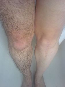 جهاز إزالة الشعر بالليزر ديود الموجات الثلاثية 808nm 755 نانومتر 1064 نانومتر جديد من Marca Km 1200wt Con 4 خطوط الطول - Product Image 6