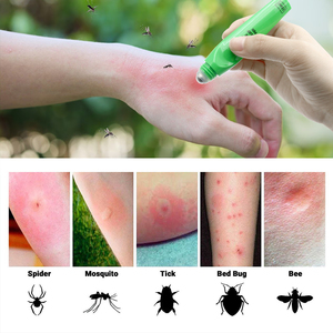 Alivio para Picaduras After Bite Advanced Formula con Aceite Esencial, Ideal para Picaduras de <span class=keywords><strong>Mosquitos</strong></span>, Hormigas de Fuego, Abejas y Más, Aplicador Portátil Tipo Bolígrafo - Product Image 4