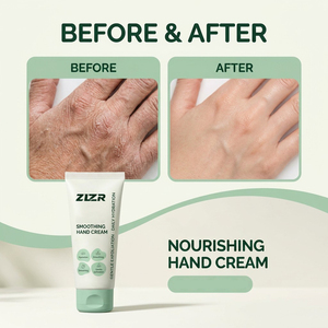 Lotion pour les mains AHA exfoliante, blanchissante, lissante et nourrissante pour les mains sèches, rugueuses et gercées, soin réparateur - Product Image 4