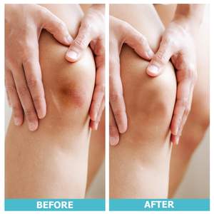 Rouleau de pansement hydrocolloïde Rouleau de matière première adhésif Jumbo Rouleau hydrocolloïde - Product Image 4