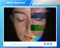 Dermoscope numérique MC88, scanner de peau du visage, topographie 3D AI, contrôle par iPad, prise EU/IT, stockage cloud, usage commercial premium