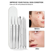 Kit Professionnel d'Aiguilles pour Points Noirs et Acné en Acier Inoxydable, Outil d'Extraction de Comédons pour Nez, Visage et Peau
