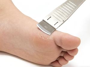 Set Professionale di Strumenti per Pedicure, Attrezzi per Unghie Incarnite, Tronchesine in Acciaio Inox, <span class=keywords><strong>Tagliaunghie</strong></span>, Rimozione Cuticole - Product Image 5