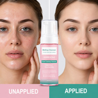 Nettoyant Moussant Visage Personnalisé OEM à la Niacinamide et à la Calamine, Nettoyant Démaquillant Micellaire Lift-Away, Mousse Nettoyante à Bulles pour la Barrière Cutanée