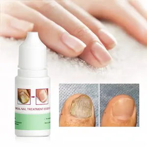 Beauty Supply Store Products Wholesale Fungus Removal Nail Restoring Solution Nail Fungus Removal Gel