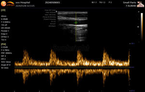 医療ポータブルPWカラー超音波スキャンマシン - Product Image 6