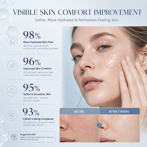 HALORINNA Creme Sorbet Calmante e Reparador 50ml – Reduz Vermelhidão Relacionada à Secura, Cuidado Facial Antioxidante Refrescante OEM - Product Image 5