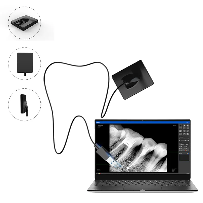 最も安い歯科用口腔機器フィルムレスデジタル歯科画像システムポータブル歯科用X線センサーデジタルX線