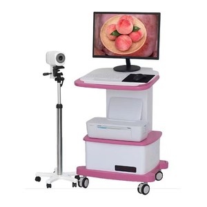 Colposcope numérique, équipement de diagnostic médical pour la chirurgie gynécologique, classe II, fabriqué à Xuzhou - Product Image 1