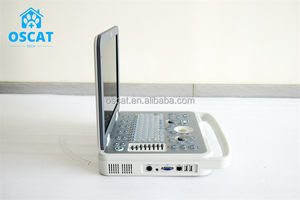 OSCAT peralatan hewan portabel <span class=keywords><strong>Laptop</strong></span>, mesin terapi <span class=keywords><strong>Ultrasound</strong></span> layar <span class=keywords><strong>LCD</strong></span> 15 inci mesin pemindai <span class=keywords><strong>Ultrasound</strong></span> 3D - Product Image 3