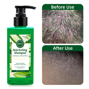 <span class=keywords><strong>Shampooing</strong></span> Capillaire Lissant Personnalisé Sous Marque Privée Hydratant Anti-démangeaisons Biologique Anti-allergie et Soin Apaisant du Cuir Chevelu - Product Image 5