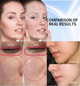 Épilateur portable 2-en-1 à lumière pulsée cellulaire IPL, en métal et ABS, avec refroidissement par glace, pour l'élimination des taches de rousseur et de l'acné, et le soin de la peau pour une beauté éclatante - Product Image 5