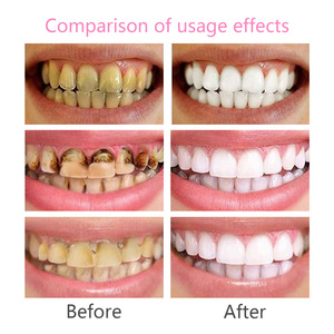<span class=keywords><strong>Dentifrice</strong></span> blanchissant à la niacinamide, éclaircissant les dents, réduisant les dépôts pigmentaires, <span class=keywords><strong>anti</strong></span>-<span class=keywords><strong>taches</strong></span>, soins bucco-dentaires, OEM, étiquette privée - Product Image 5