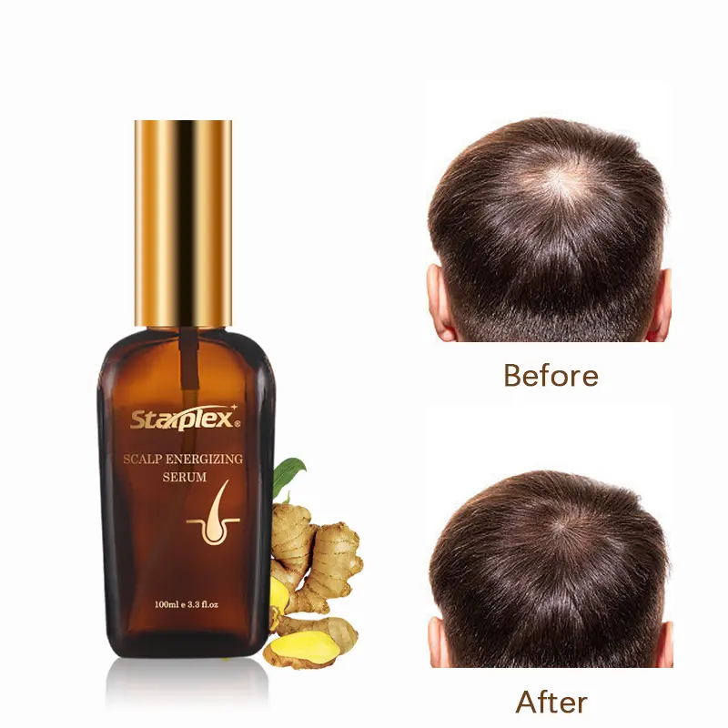 Starplex Natural Herbal biotina nutriente per la ricrescita dei capelli olio per il trattamento dei capelli Ginger Hair Grow Serum for Men