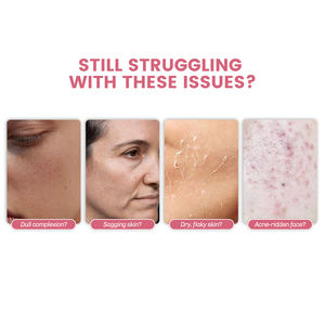 Suero Equilibrante con Niacinamida + Péptido Rosa 12, Controla la Grasa, Ilumina la Piel Opaca, Minimiza los Poros, para la Rutina Diaria de la Piel, 30 ml - Product Image 5