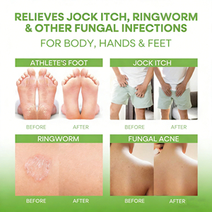 Jabón en Barra <span class=keywords><strong>de</strong></span> Aceite <span class=keywords><strong>de</strong></span> Árbol <span class=keywords><strong>de</strong></span> Té Vegano Natural <span class=keywords><strong>al</strong></span> <span class=keywords><strong>por</strong></span> <span class=keywords><strong>Mayor</strong></span>, Jabón Facial Herbal Antifúngico <span class=keywords><strong>de</strong></span> Limpieza Profunda, Control <span class=keywords><strong>de</strong></span> Acné y Espinillas, Nueva Fórmula - Product Image 3