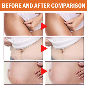 Venta caliente suaviza la piel a la perfección enriquecida con glicerina vitamina E crema de masaje corporal de semilla de uva - Product Image 2