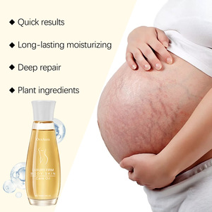 Mới Sâu Sửa Chữa Bị hư hỏng Phục Hồi Độ Đàn Hồi Lâu Dài Giữ Ẩm Sau Sinh Căng Thắt Chặt Dầu Cho Phụ Nữ Mang Thai - Product Image 1