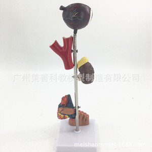 Modelos de patología de la diabetes, modelos de corazón, modelos de riñón, modelos de ojo, modelos de pie diabético, modelos de diabetes - Product Image 3