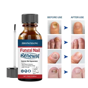 OEM天然指甲治疗油，有效预防指甲感染真菌指甲治疗受损